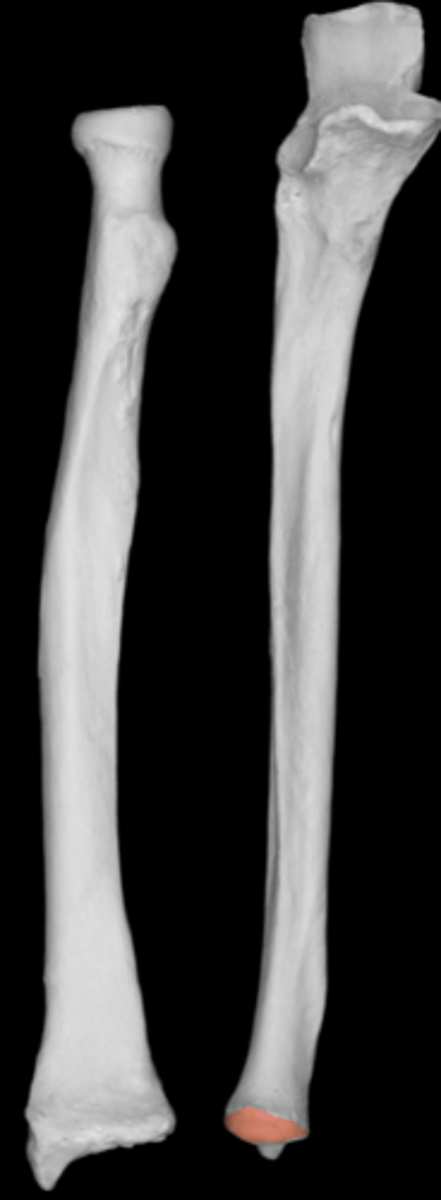 <p>distal end</p>