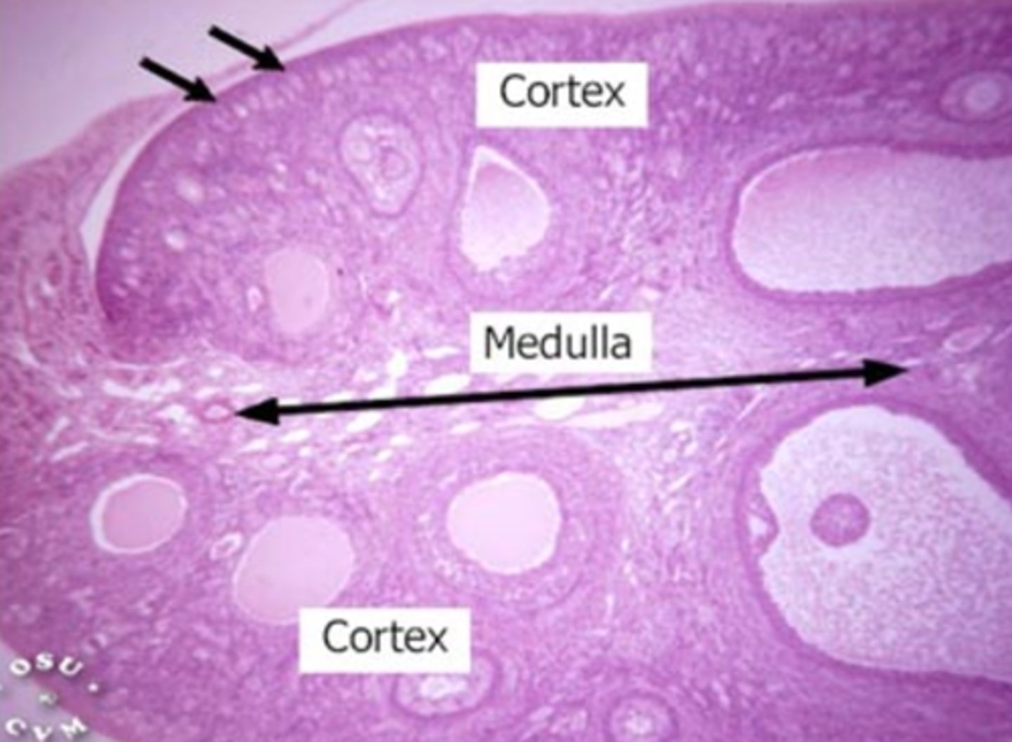 <p>Follicles</p>