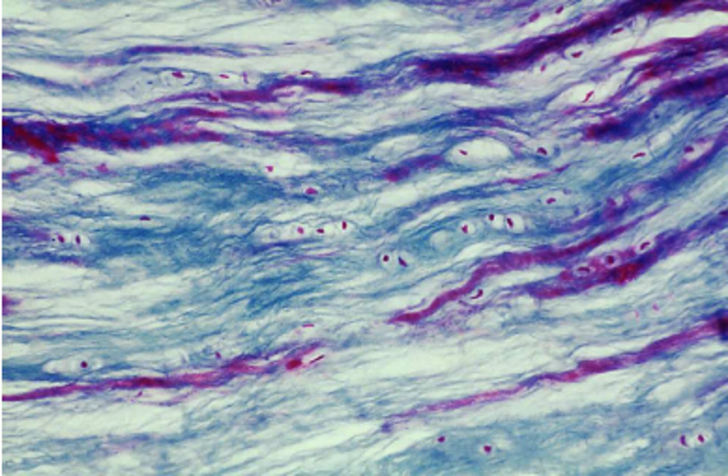 <p>What cartilage is this?</p>