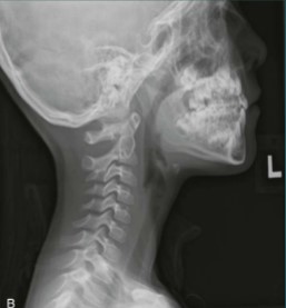 <p>What projection, position, and anatomy is this?</p>