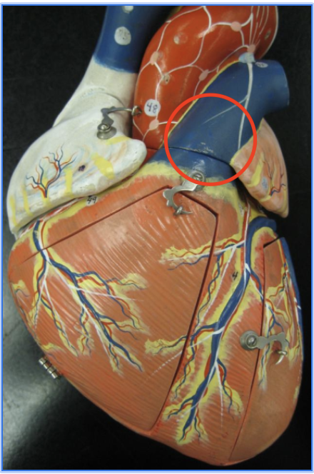 <p>left lateral tube above semilunar valves</p>