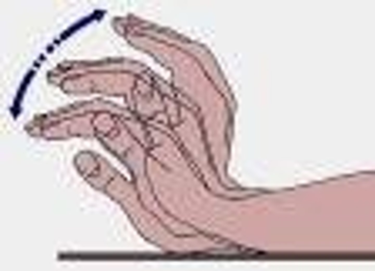 <p>a positive symptom on the schizophrenic spectrum characterized by unusual movements or behaviors that can range from childlike silliness to unpredictable agitation</p>