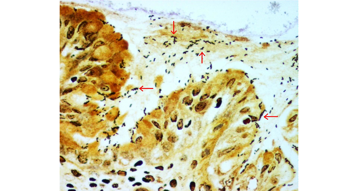 term image