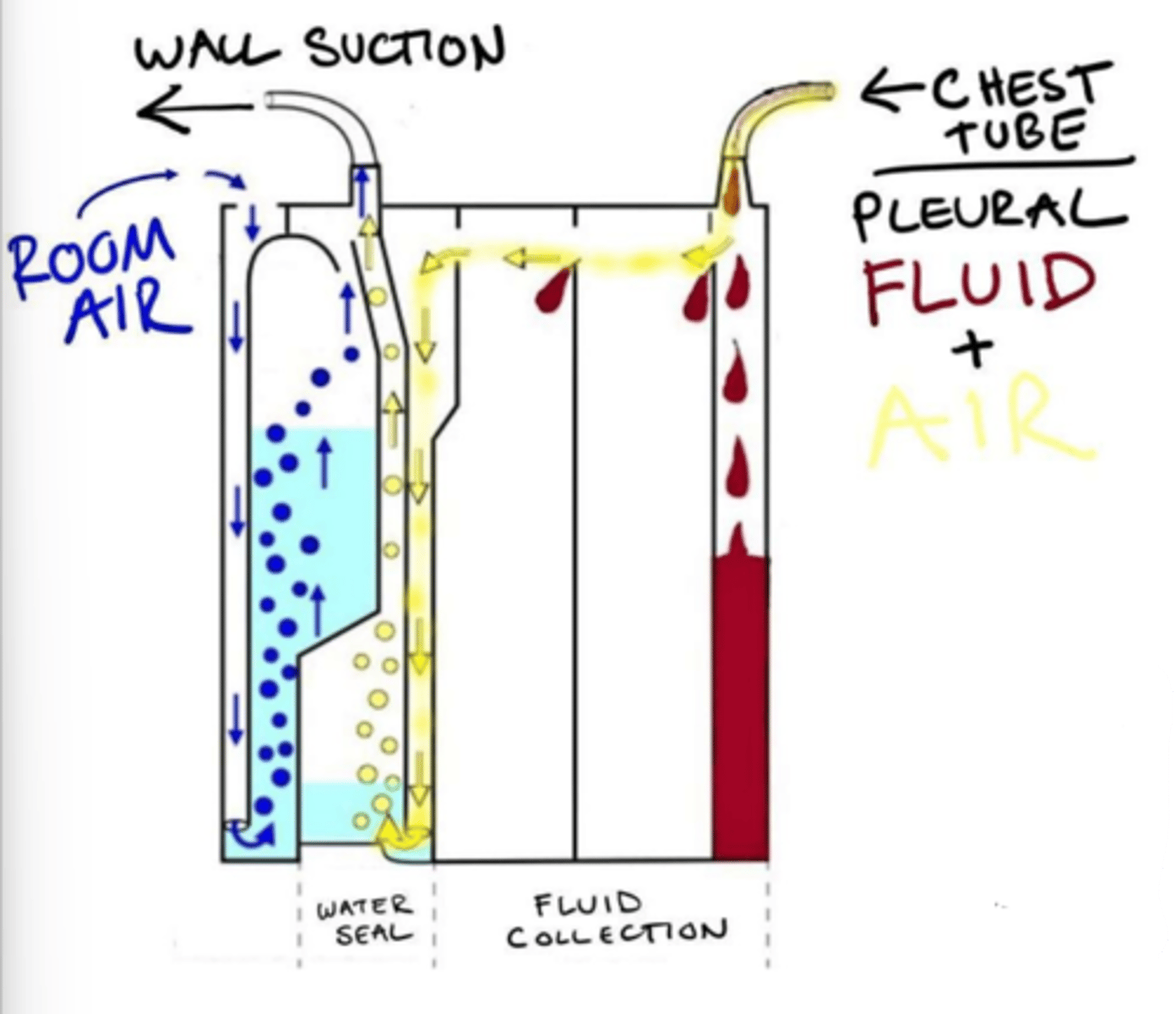 <p>Applies negative pressure - pulls fluid/air.</p>