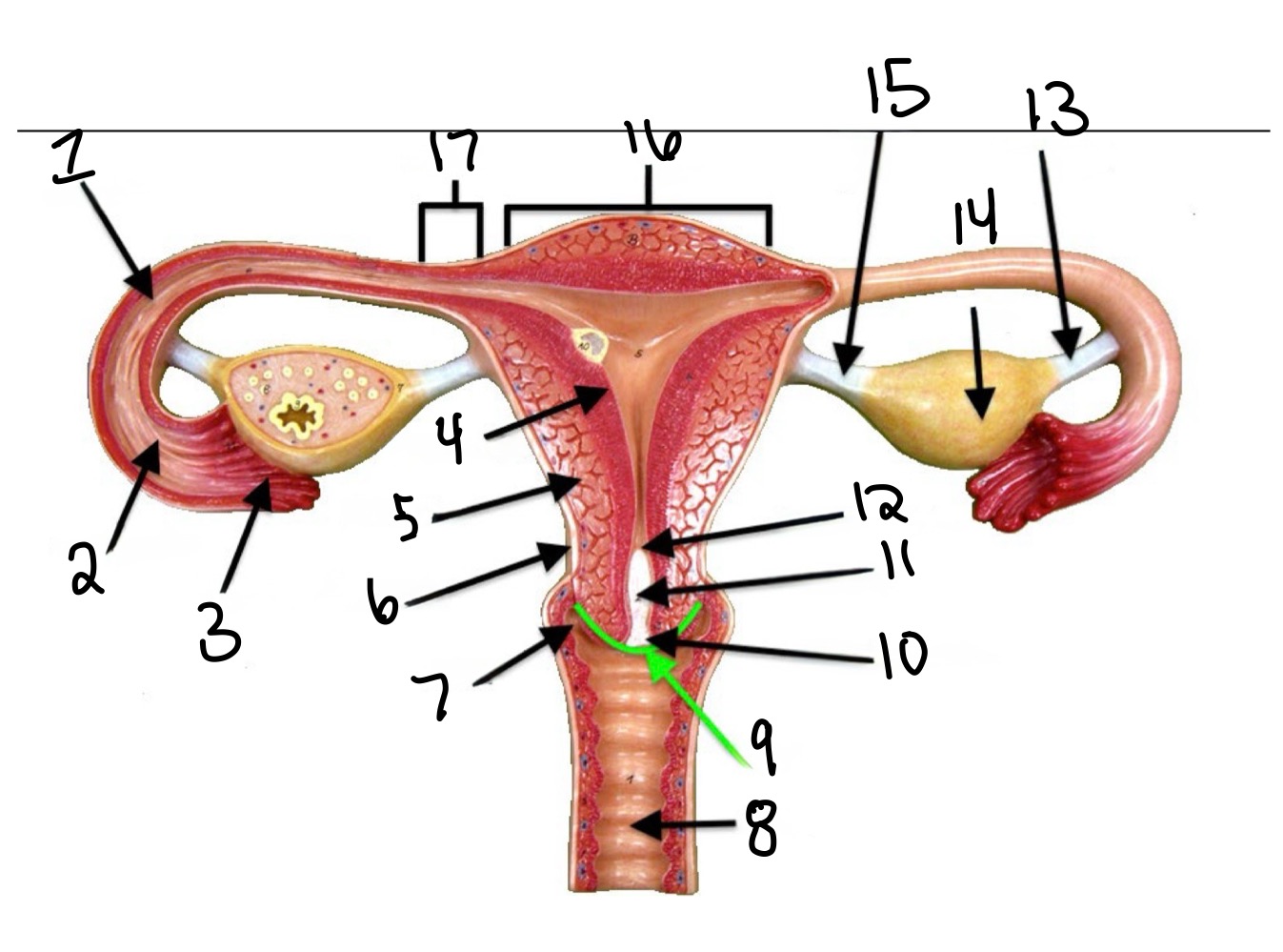 <p>Suspensory ligament</p>