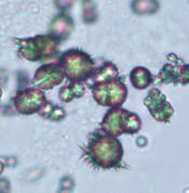 <p><span style="color: purple">A-Ammonium urate crystals occur at alkaline pH only.</span> The pH should be checked, and if below 7.0, the crystals should be reviewed in order to identify correctly. The trace ketone does not require confirmation, provided that the quality control of the reagent strips is acceptable.</p>
