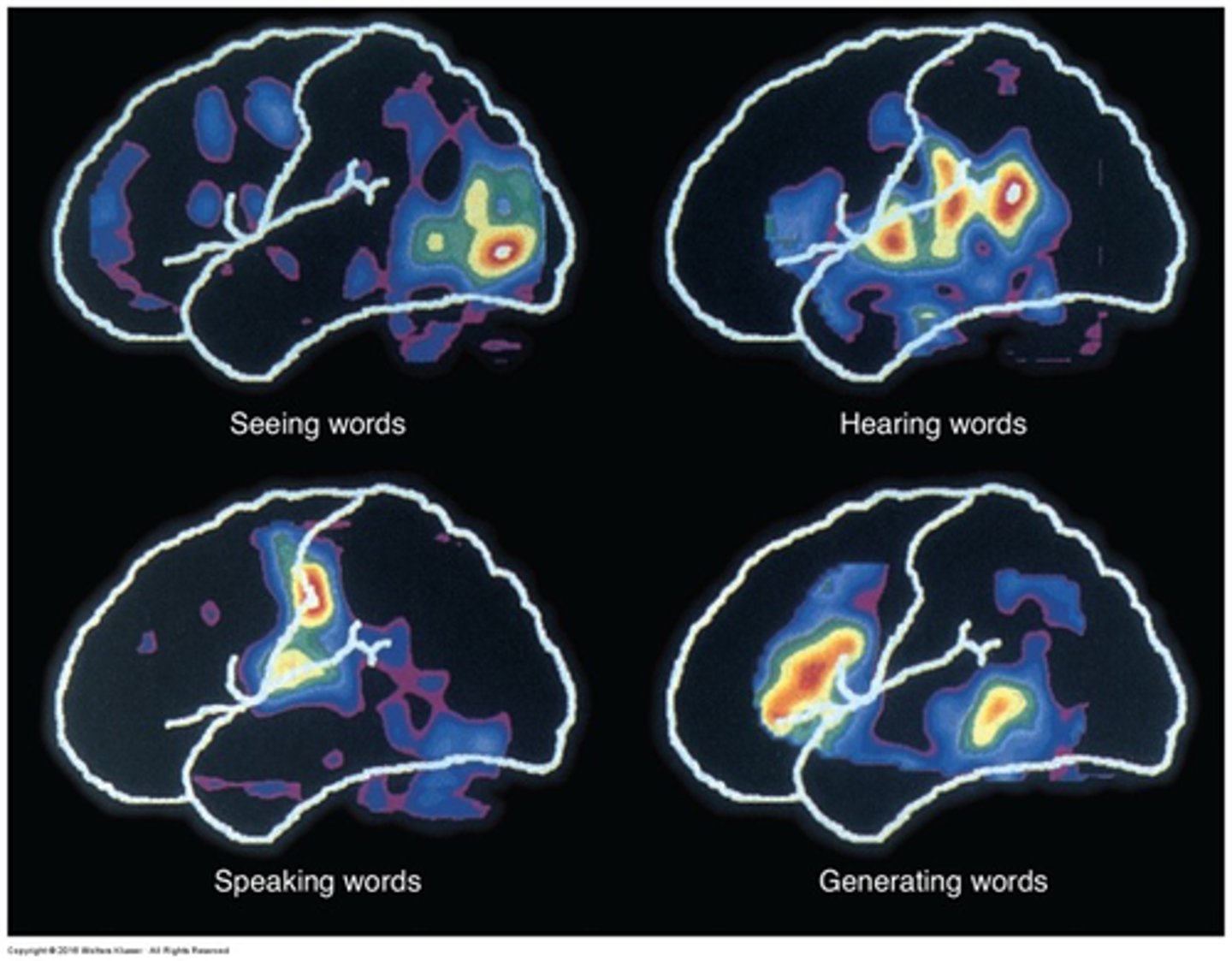 <p>What are the 3 kinds of non-invasive functional imaging you can use to map the cortex?</p>