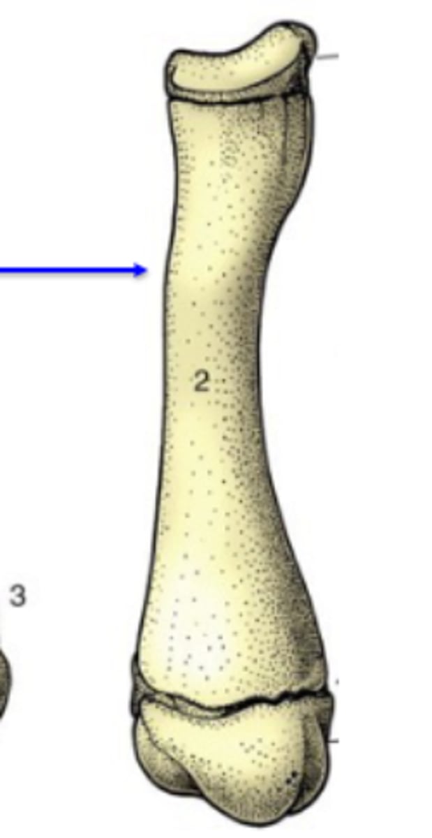 <p>Bone shape?</p><p>-typical of the limbs</p><p>-three centers of ossification: one for the shaft (diaphysis), and one for each extremity (epiphysis)</p><p>-have a medullary cavity</p><p>3 multiple choice options</p>
