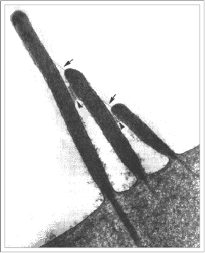 "tugs" on cation channels of hair cells; floods K+ and Ca2+