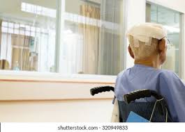<p><strong>During a clinical assessment of a 68-year-old client who has suffered a head injury, a neurologist suspects that a client has a sustained damage to her vagus (CN X) nerve. Which of the following assessment findings is most likely to lead the physician to this conclusion?</strong></p><p>A) The client has difficulty swallowing and has had recent constipation and hypoactive bowel sounds.</p><p>B) The client is unable to turn her head from side to side, and her tongue is flaccid.</p><p>C) The client has a unilateral facial droop, dry eyes, and decreased salivary production.</p><p>D) The client is unable to perform any fine motor movements of her</p><p>tongue. </p>