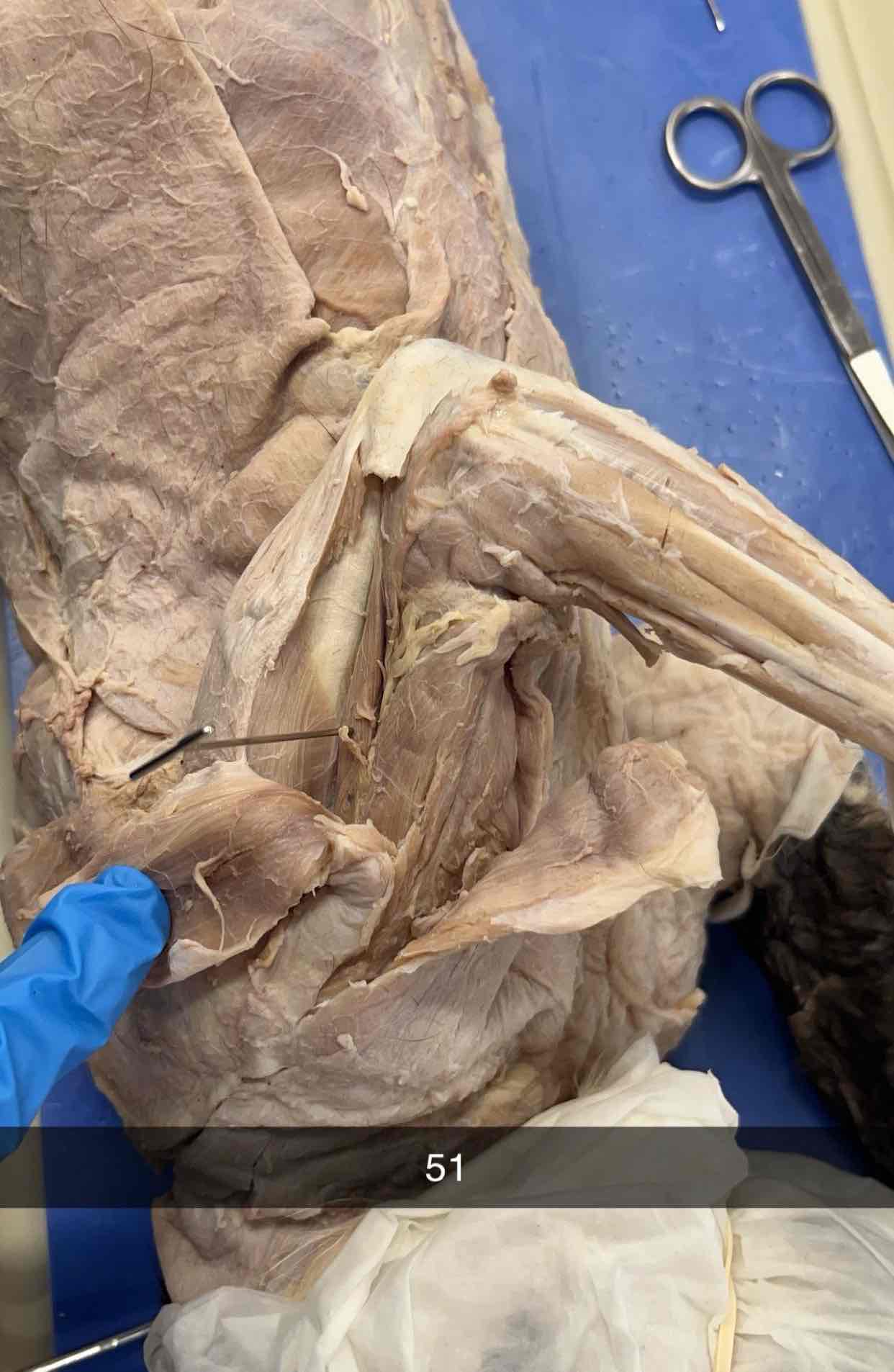 <p>What muscle is this?</p>