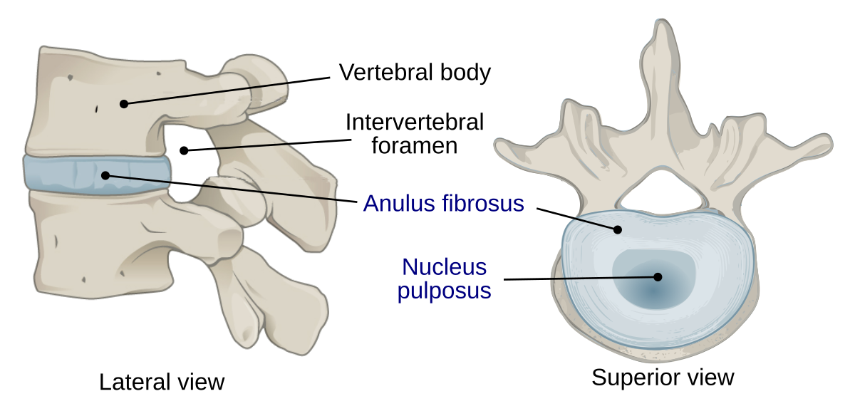 <p>between 2 vertebrae</p><ul><li><p>jelly center —&gt; nucleus pulposus</p></li><li><p>surrounding ring —→ annulus fibrousus</p></li></ul><p></p>