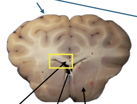 <p>What is this highlighted figure?</p>