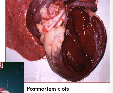 <p>softer</p><p>do NOT have point of attachment</p><p>do NOT have associated lesions</p>