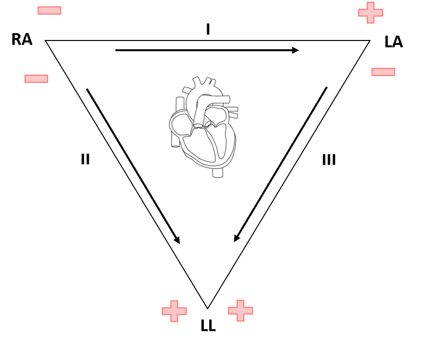 <p><strong>FILL</strong>: Lead <strong>II</strong>: _____ arm (<strong><em>-</em></strong>) and ____ leg (<strong>+</strong>); views the <strong>inferior </strong>surface of the heart</p>