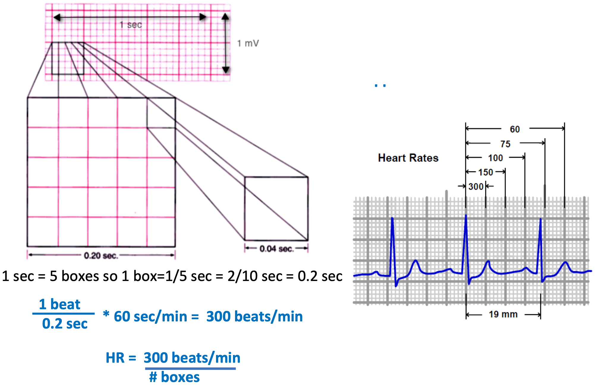 <ol><li><p>Quick estimation</p></li><li><p>Steps</p><ol><li><p>Start with an R wave aligned with line of a large box</p></li><li><p>Assign values of 300, 150, 100 to next 3 \n boxes</p></li><li><p>Assign values of 75, 60, 50 to next 3 boxes after that</p></li><li><p>Assign H.R. based on where next R wave appears</p></li></ol></li></ol>