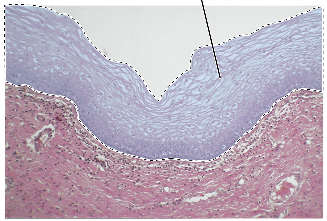 <p>Name the highlighted tissue.</p>