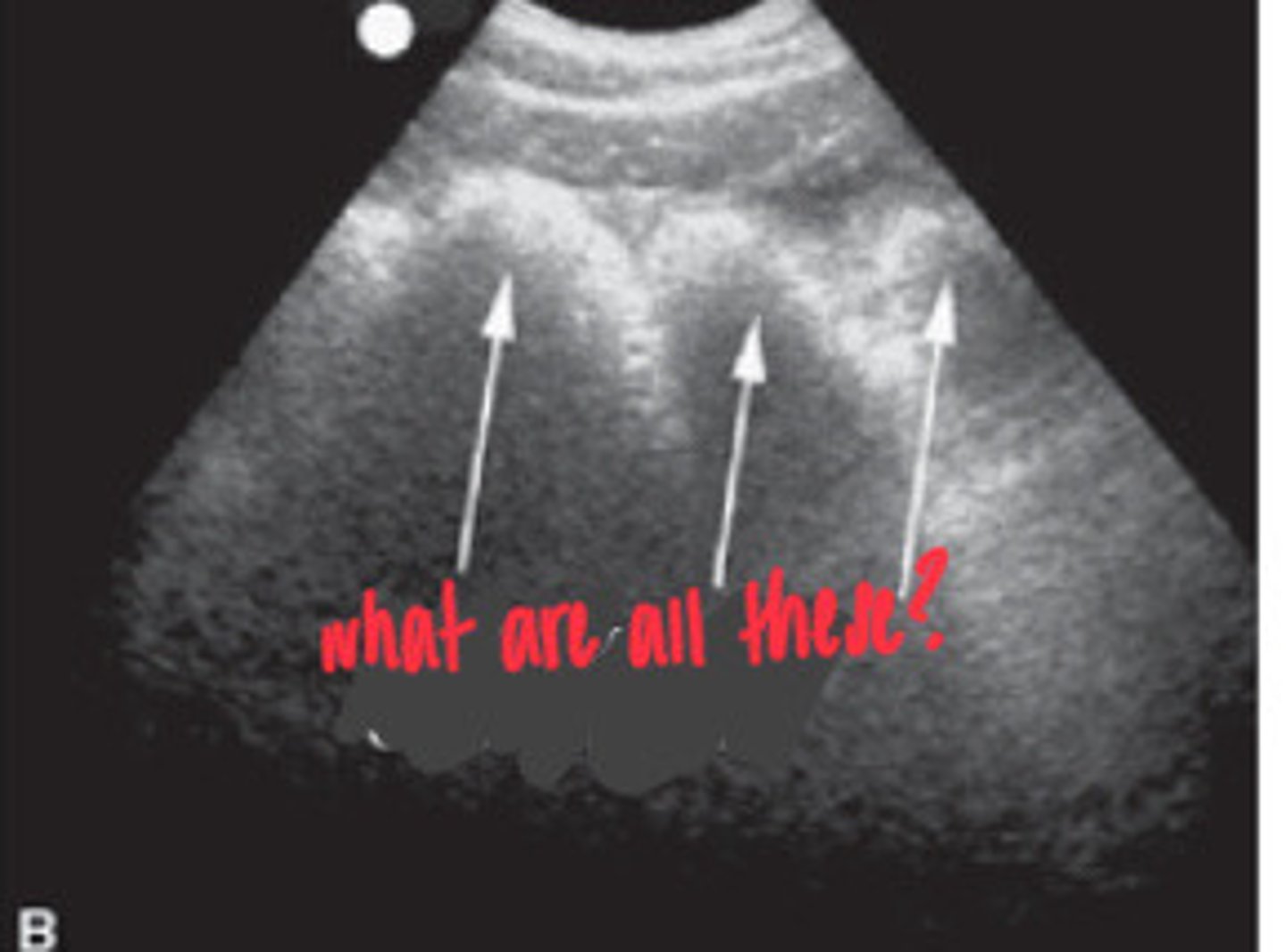 <p>What FLASH view is this in horses and what are the arrows showing you?</p>