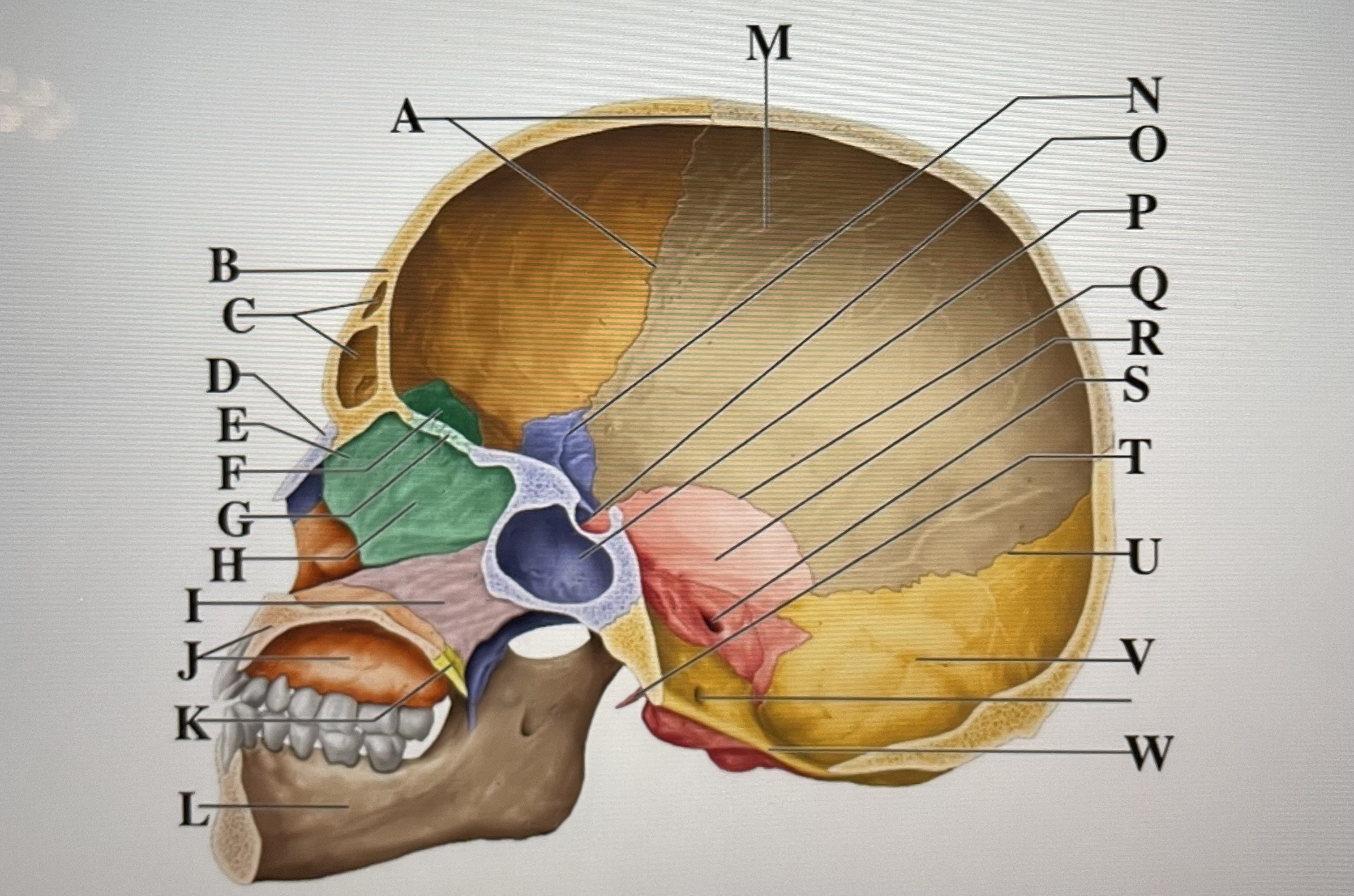 In the figure above  *is the perpendicular plate and* _ is the internal acoustic meatus 