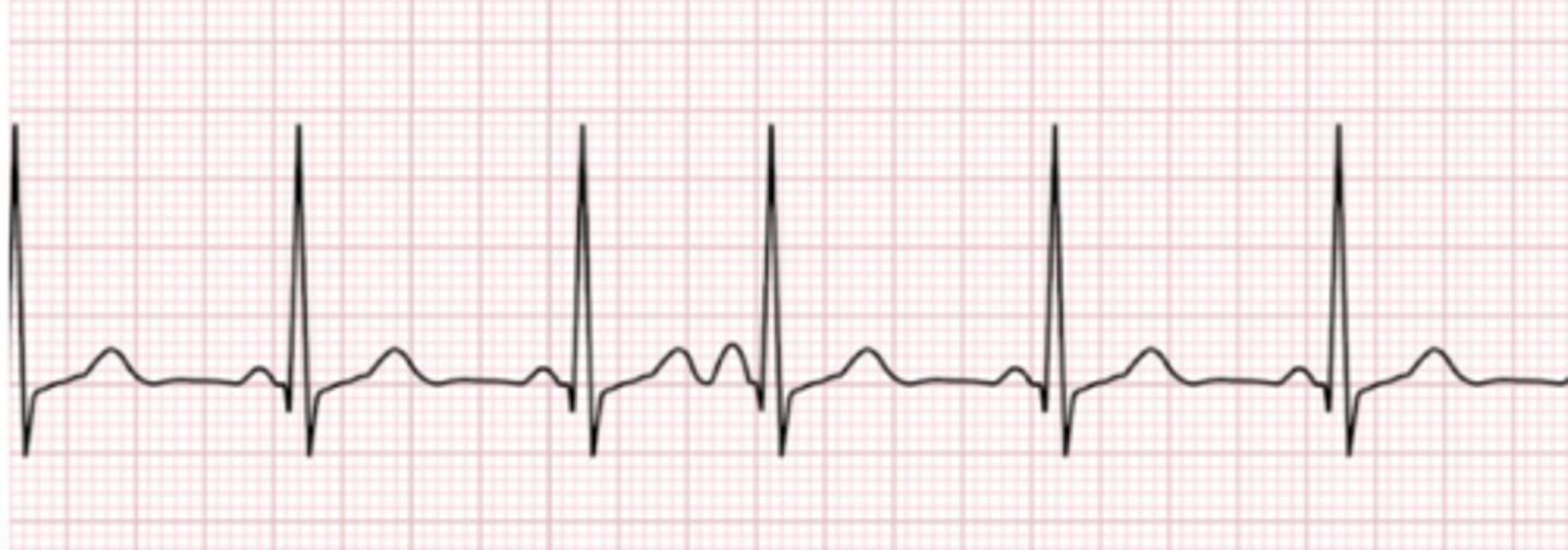<p>Name the rhythm</p>
