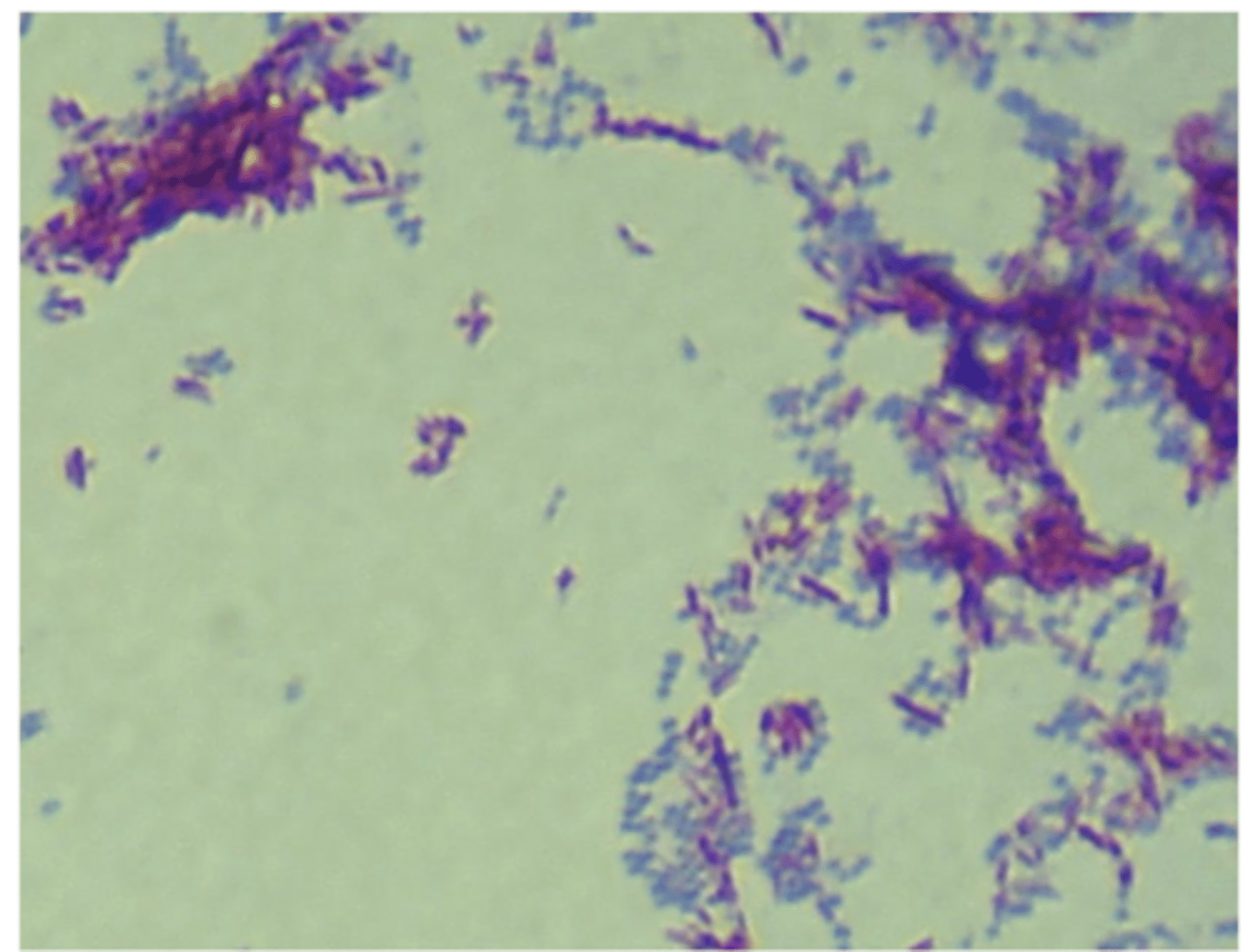 <p>Staphylococcus- blue</p>