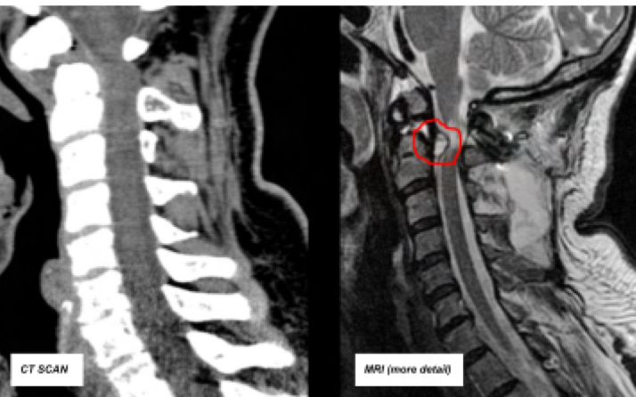 <p>For better imaging in specific areas, the coils/antennas help in recieving the reflected signal as close as possible in rder to achieve a better imahge</p>