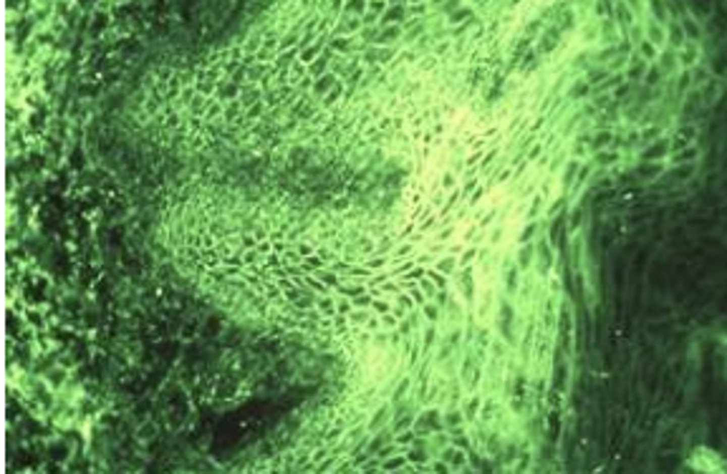 <p>What cell layer is affected in pemphgUs (PICTURE ON DRIVE)?</p>