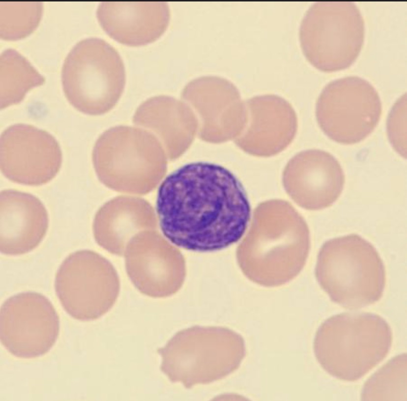 <p>What is this leukocyte?</p>