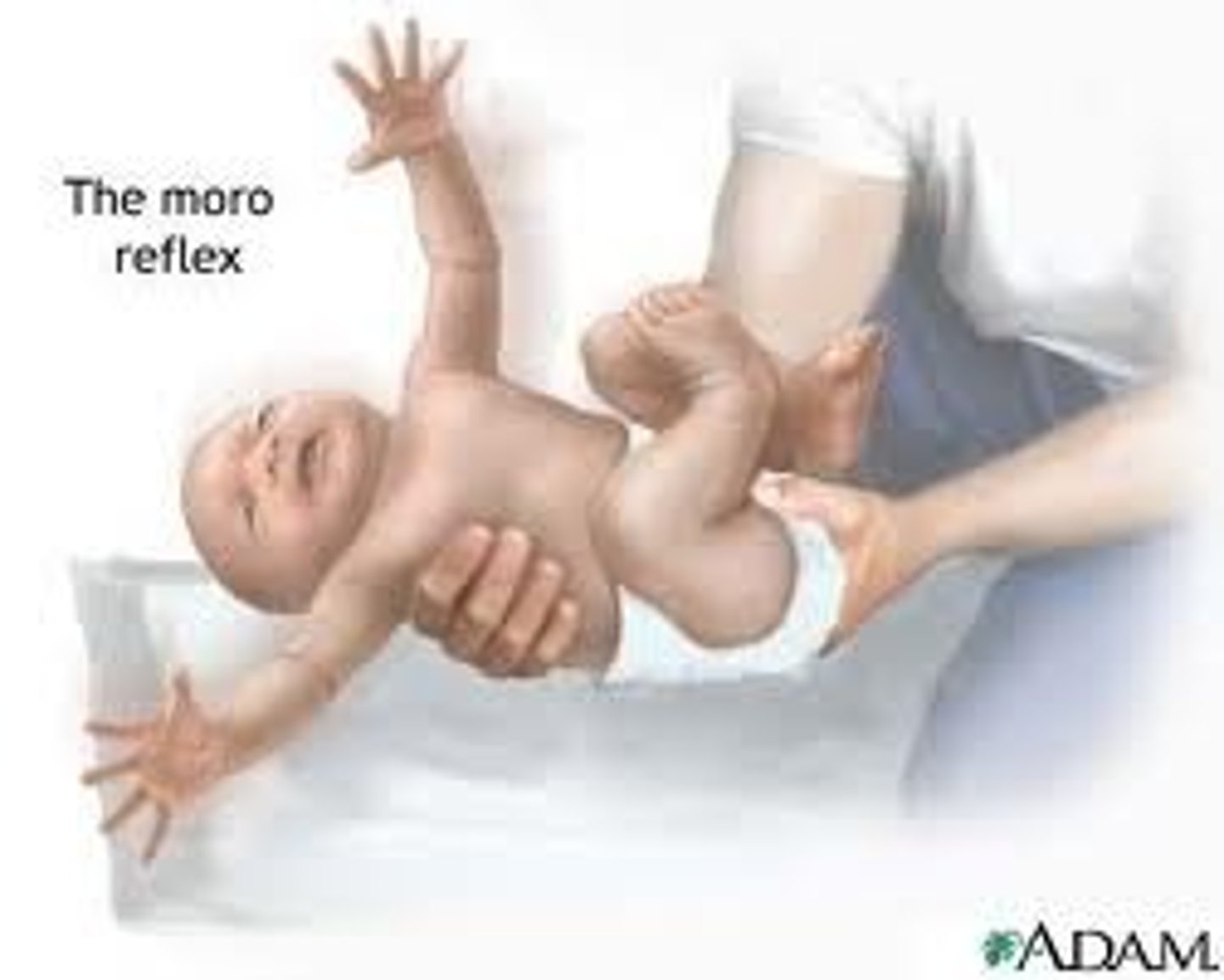 <p>Fight or Flight</p><p>Birth to 2-4 mo</p><p>Baby is lowered rapidly, head is thrown back, arms extend, cries</p>