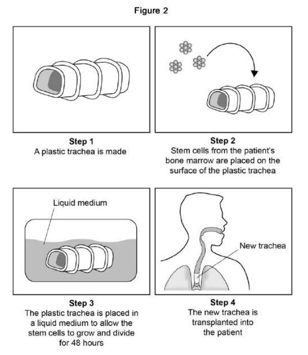 <p>Scientists can treat a patient’s tumour by replacing the trachea with a plastic trachea. The plastic trachea has a layer of the patient’s own stem cells covering it. Figure 2 shows the procedure. Give two advantages of using the stem cell trachea compared with a trachea from a dead human donor.</p>