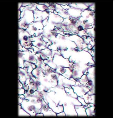 <p>Location: Bone Marrow</p><p>Function: Provides Supportive </p>