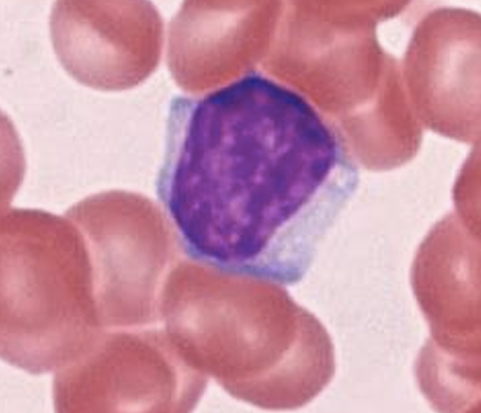 <p>T Lymphocyte</p>