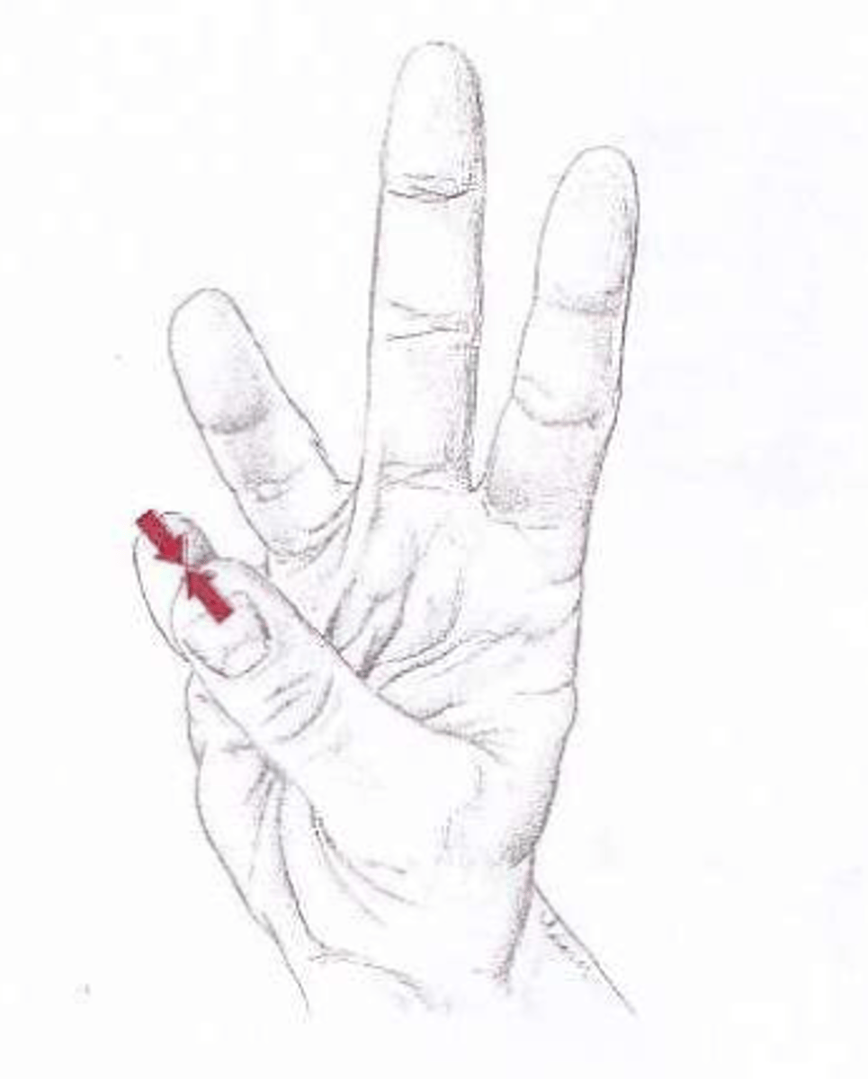 <p>Moving the thumb to touch the fingertips</p>