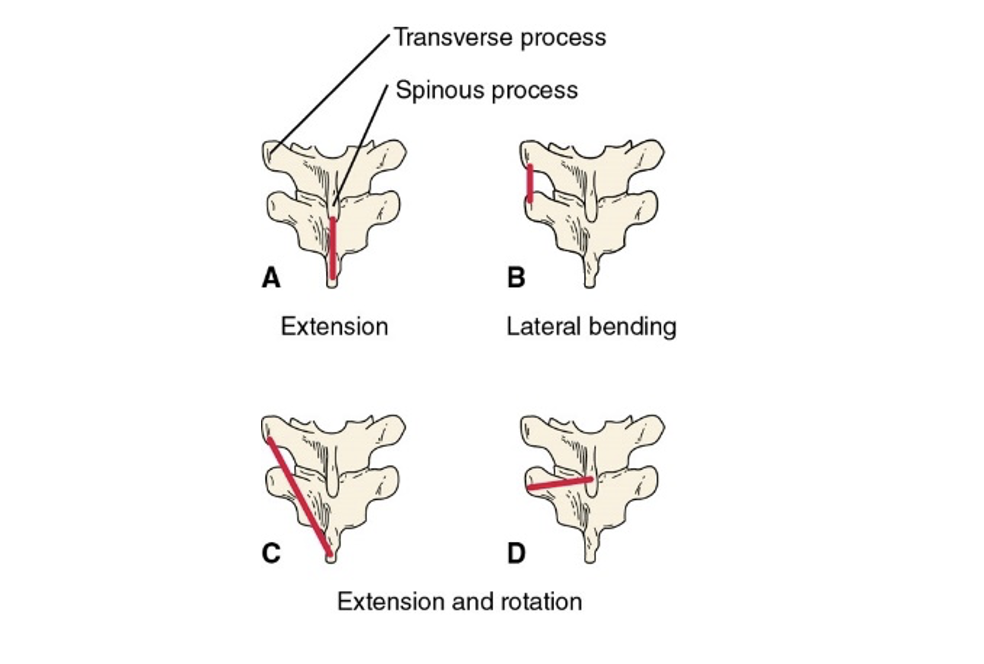 <p><span><span>Determines muscle action for posterior trunk muscles</span></span></p>