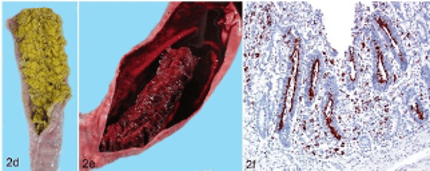 <p>this disease state is likely associated with what condition</p>