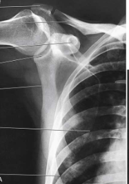<p>What type of projection, position and anatomy is this?</p>