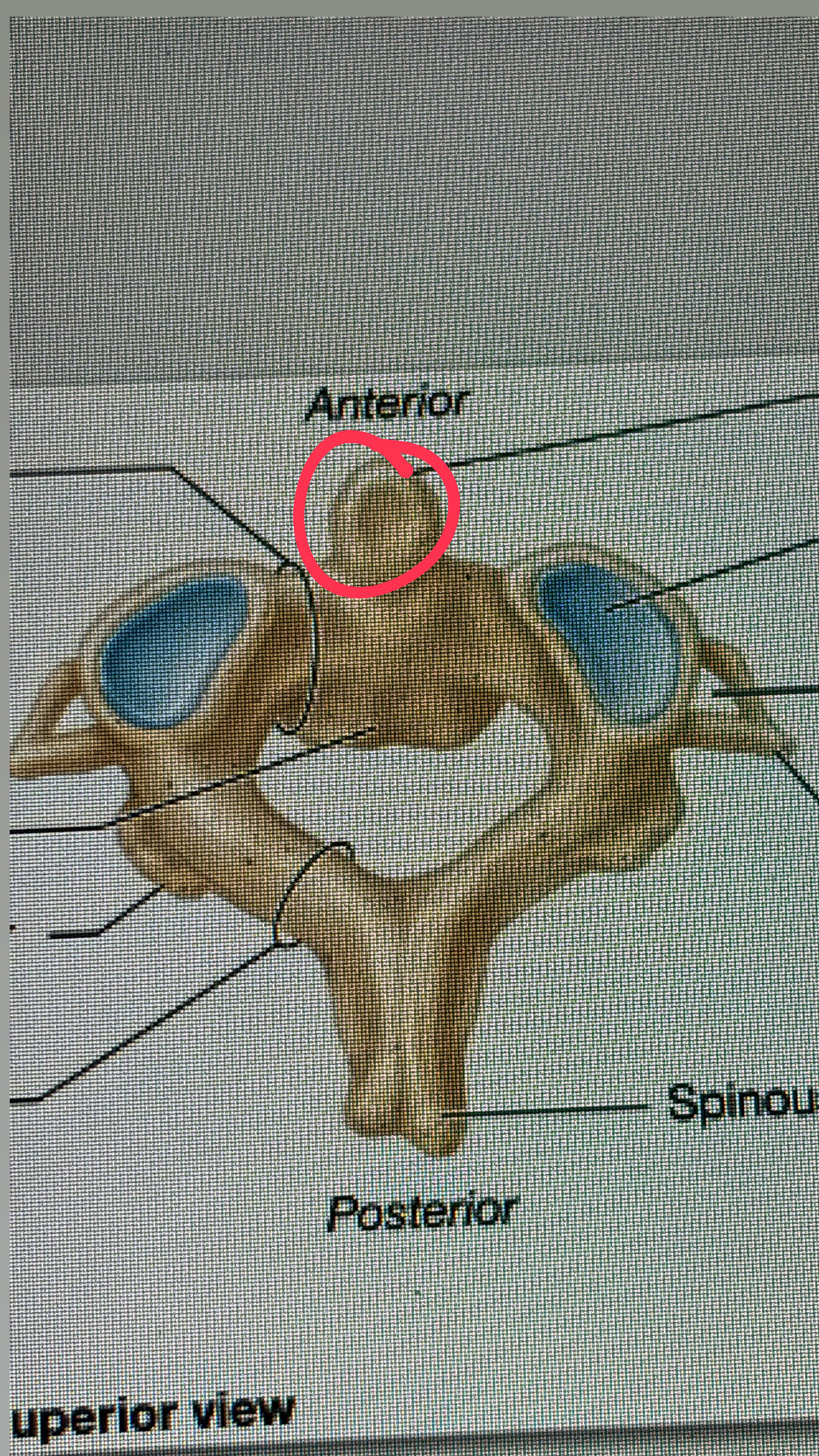 <p>head of the “football player”</p>