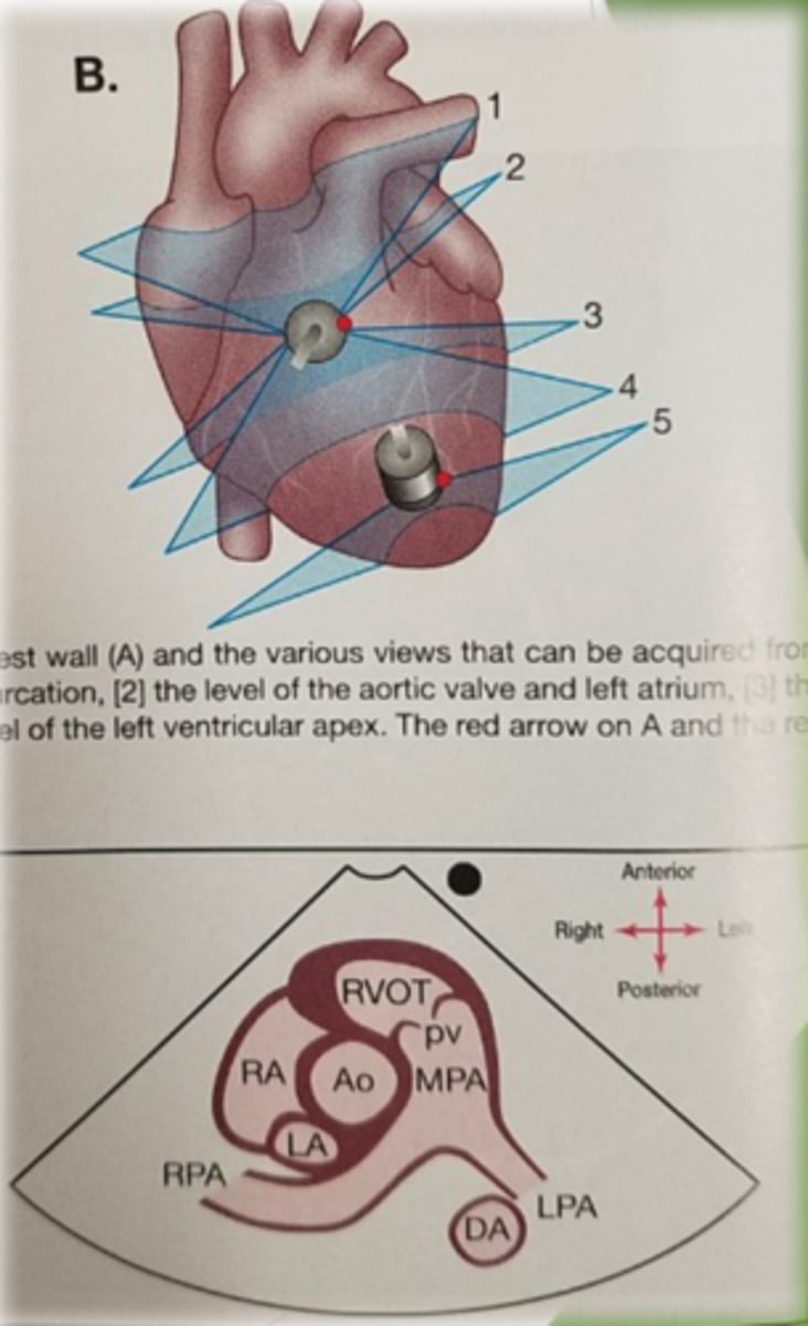 <p>1. PA</p><p>2. PSAX AV, LA</p><p>3. PSAX LV, MV</p><p>4. LV papillary muscles</p><p>5. PSAX LV apex</p>