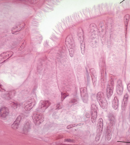 <p>What tissue type does this image depict?</p>