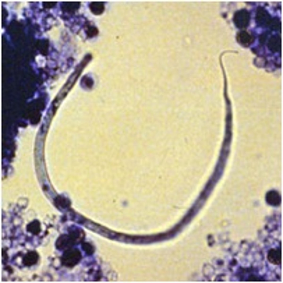 <p>Acanthocheilonema reconditum</p>