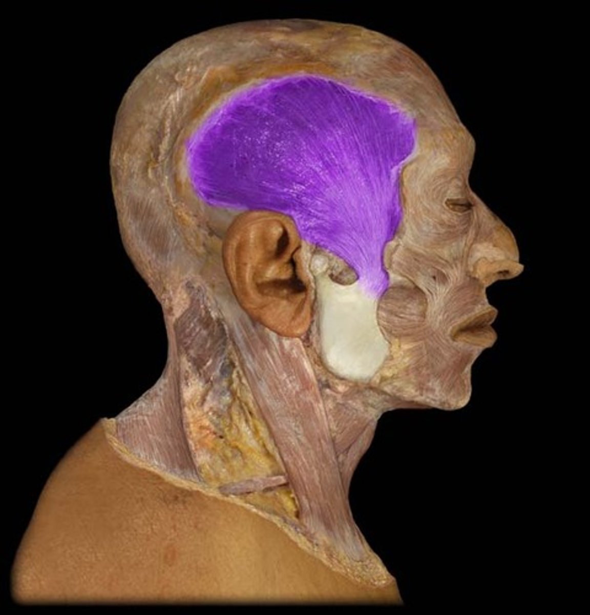 <p>elevation and retraction of mandible</p>