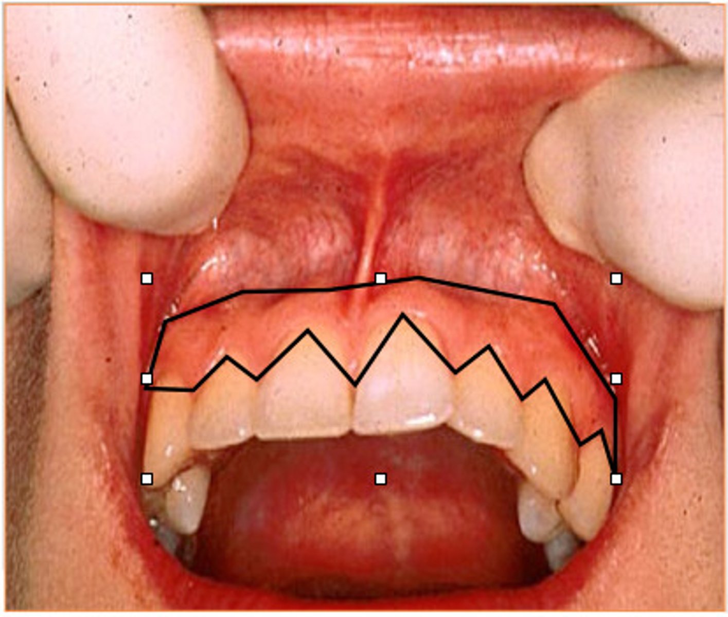 <p>Helps secure the teeth in place</p>