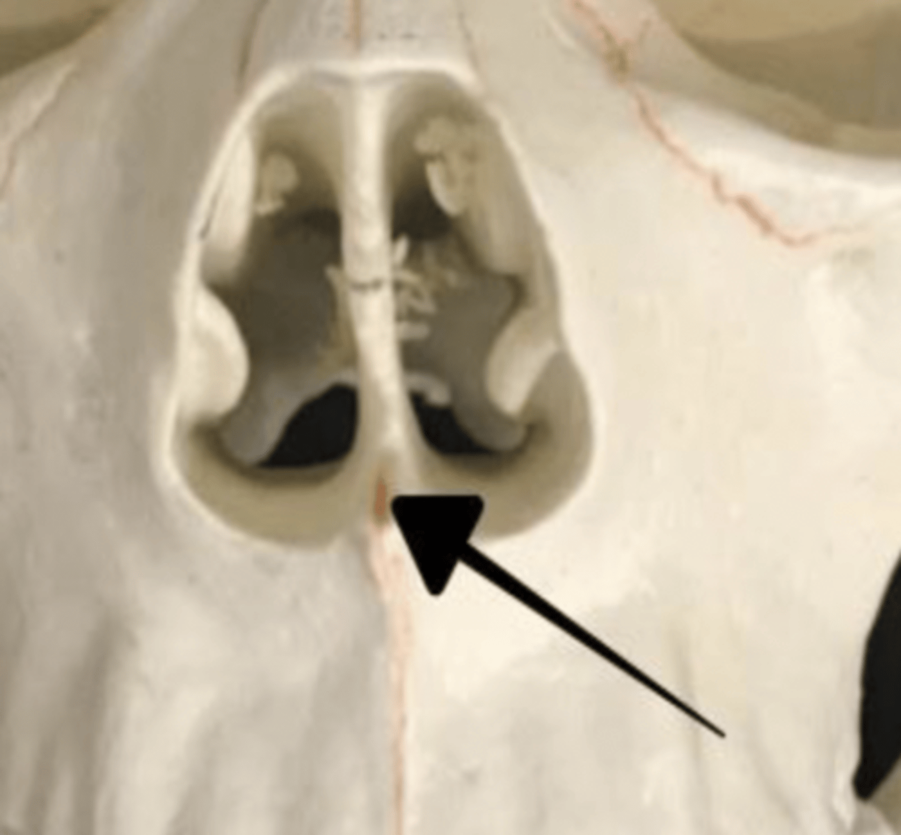 <p>the vomer bone</p>