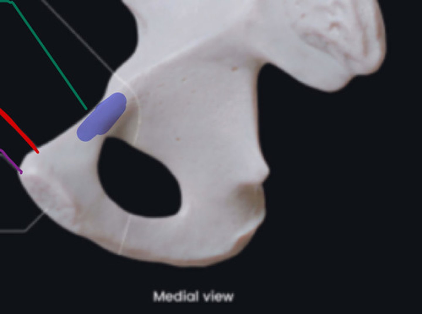 <p>what is the green arrow pointing to on the pubis</p>