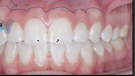 <p>Blue line and blue hilighetd regions</p>