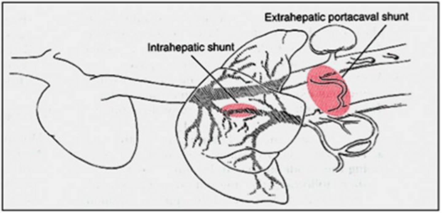 <p>An abnormal vascular structure allowing portal blood to bypass the liver and drain directly into the systemic circulation.</p>