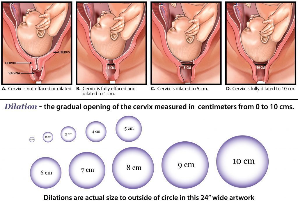 <p>Dilatation means that the cervix opens</p>