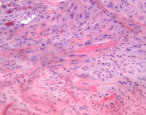 <p>What is this tissue?</p>