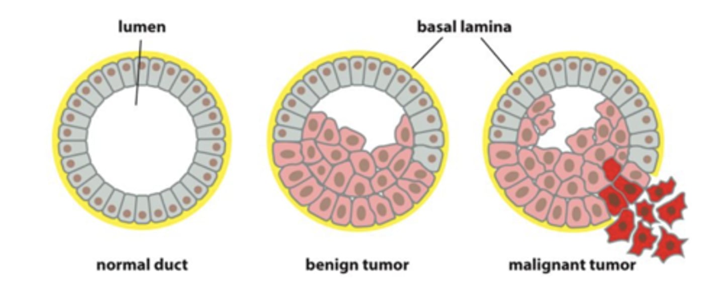 <p>Benign: does not spread or invade surrounding tissue</p><p>Malignant or cancerous: invade other tissues</p>