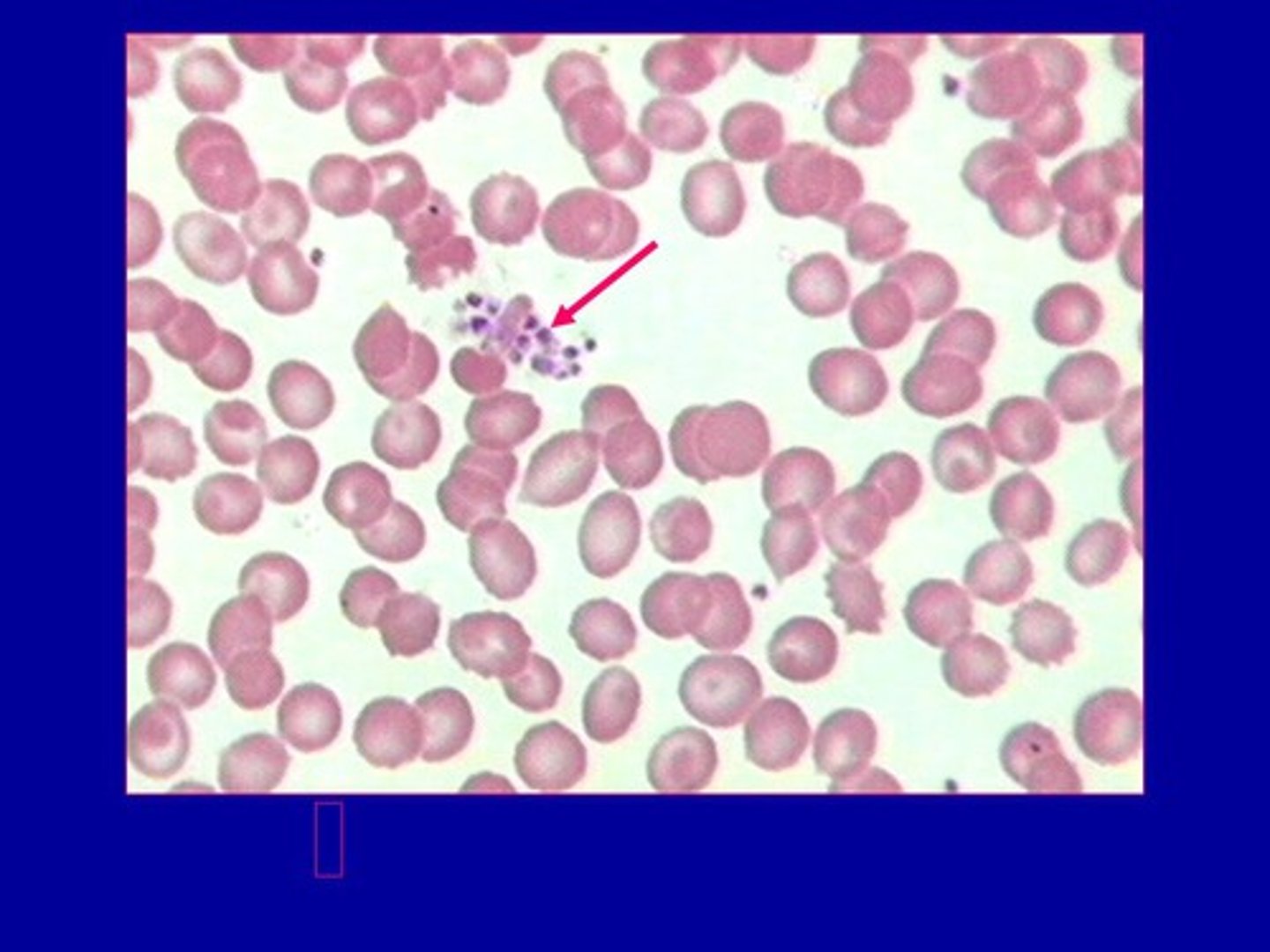 <p>- function: hemostasis (stopping bleeding) and wound healing</p><p>- 150,000–400,000 in 1 mm³</p><p>- They are NOT cells but cell fragments </p><p>- elevated platelet count = thrombocytosis</p><p>- low platelet count = thrombocytopenia</p>